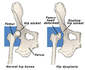 Hip dysplasia sales in yorkies